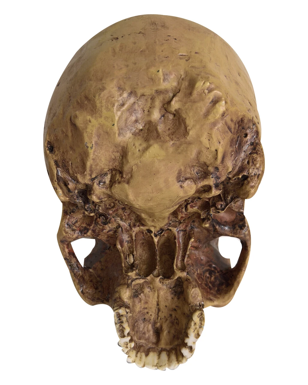 Antiker Totenschädel Ohne Unterkiefer 19cm – Bild 4