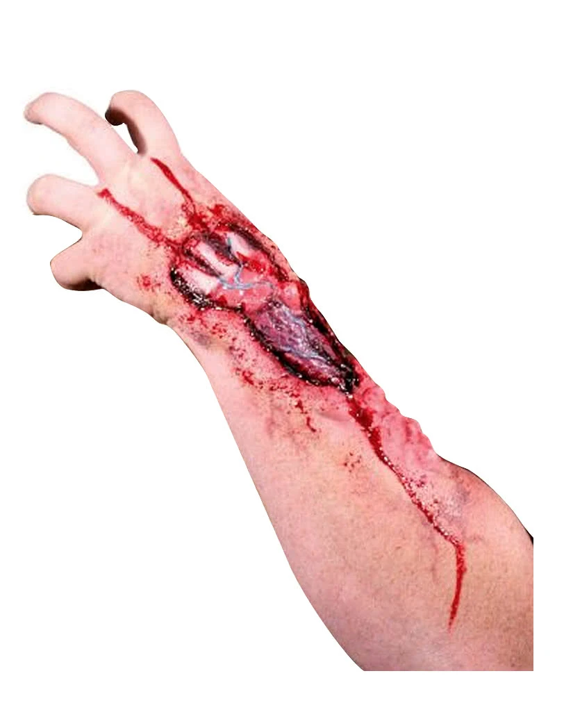 Weggefressener Unterarm Latexwunde