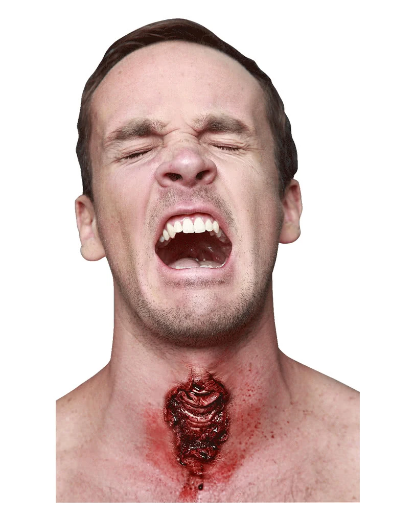 Luftröhrenschnitt Latexapplikation