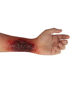 Latexwunde Trypophobie